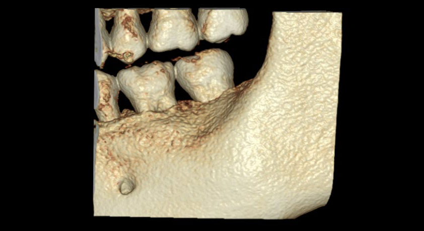 Dentri Sistema Dental Cbct Tac D Recursos M Dicos