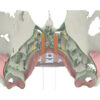 Ortodoncia digital