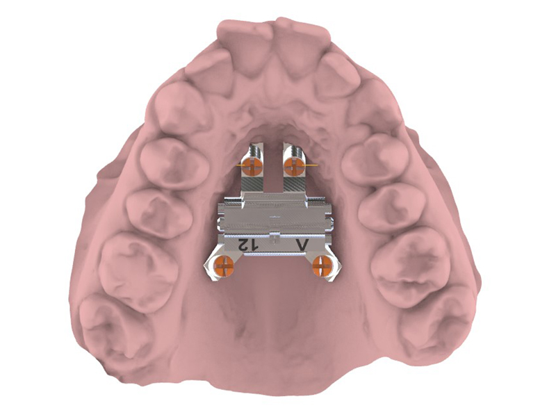Ortodoncia digital