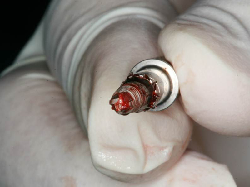 FR Kit Extractor de implantes