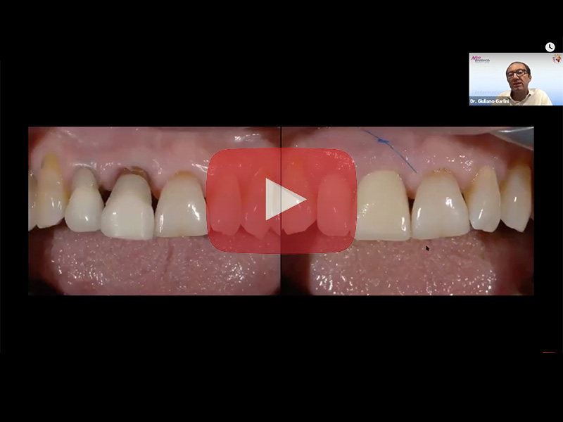 Webinar Dr. Garlini