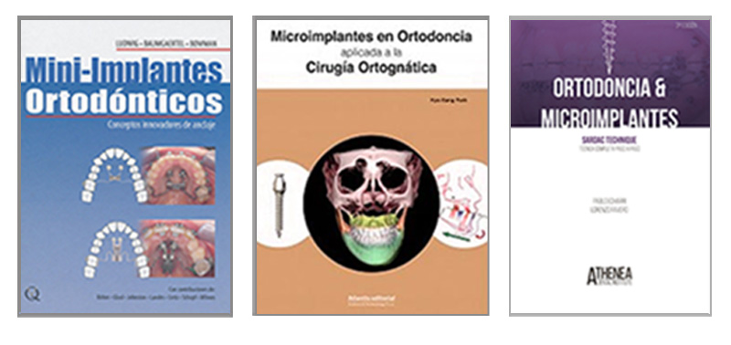 Libros microtornillos ortodoncia