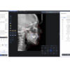eco-x CBCT Software