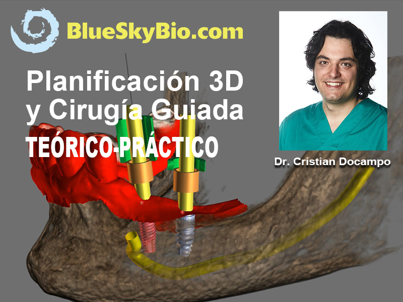 Dr. Cristian Docampo, Planificación 3D y Cirugía Guiada