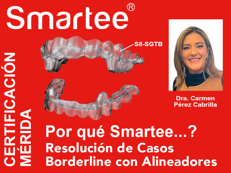 Por qué Smartee...?