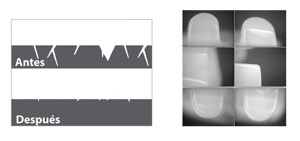 Bracket Biocetec de cerámica, superficie nanpulida